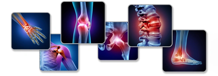 Medical illustration collage highlighting joints and spine areas, including hand, shoulder, knee, hip, neck, and ankle.