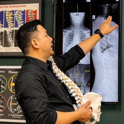 Person pointing at spinal X-ray images while holding an anatomical spine model in a clinical setting.